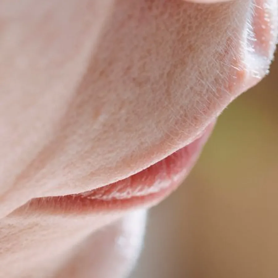 Cilt Peelingi Özel Seri